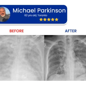 Seagril™ Tri-NanoTargetCOPD Relief Patch