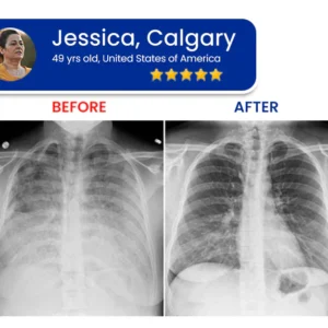 Seagril™ Tri-NanoTargetCOPD Relief Patch