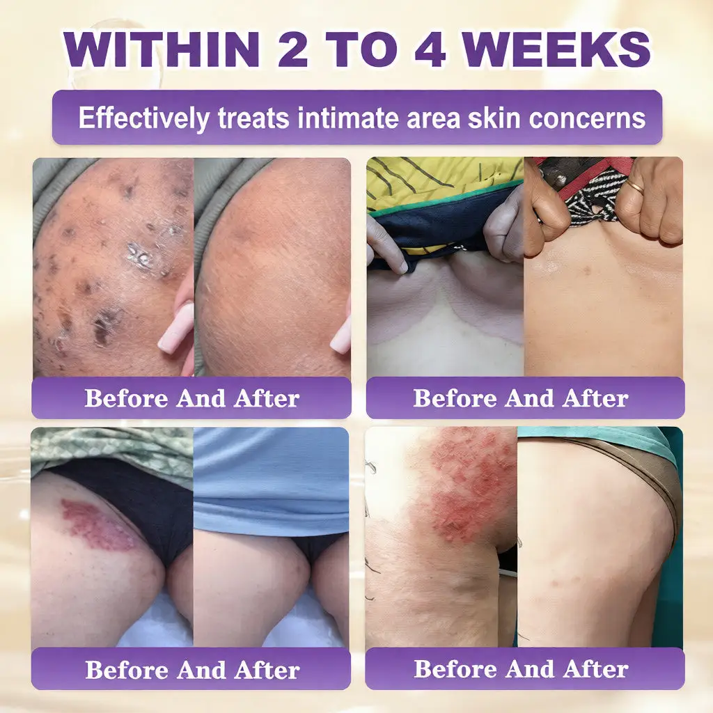 SEAGRIL® Biotin 10-in-1 Skin Restoration Cream