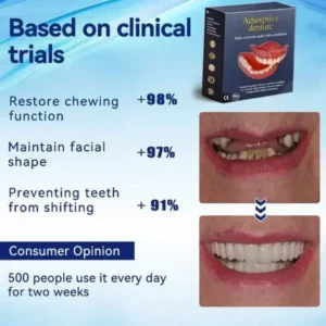 Seagril™ Adhesive teeth (upper and lower)