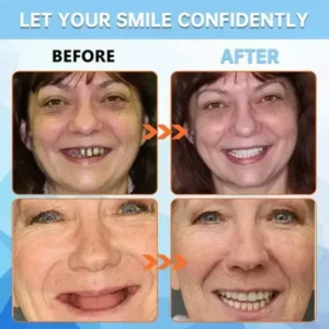 Seagril™ Adhesive teeth (upper and lower)