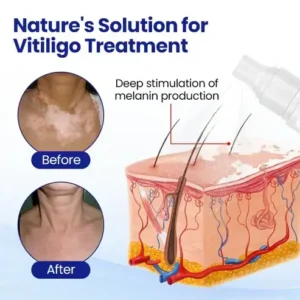 Seagril® Evenora Herbal Spray