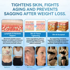 ๐ญ๐๐๐๐๐๐๐ยฎ ๐ท๐ณ๐จ๐ต๐ป-๐ซ๐ฌ๐น๐ฐ๐ฝ๐ฌ๐ซ ๐ช๐๐๐๐๐๐๐ ๐บ๐๐๐๐๐๐ ๐ช๐๐๐๐๐๐ ๐ท๐๐๐๐(Plant energy helps reduce weight by improving the body's lymphatic system)๐ฉน