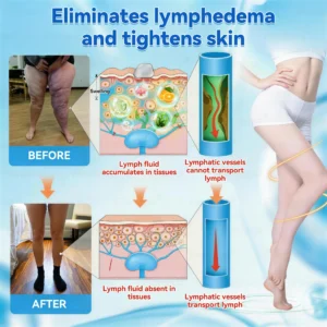 ๐ญ๐๐๐๐๐๐๐ยฎ ๐ท๐ณ๐จ๐ต๐ป-๐ซ๐ฌ๐น๐ฐ๐ฝ๐ฌ๐ซ ๐ช๐๐๐๐๐๐๐ ๐บ๐๐๐๐๐๐ ๐ช๐๐๐๐๐๐ ๐ท๐๐๐๐(Plant energy helps reduce weight by improving the body's lymphatic system)๐ฉน