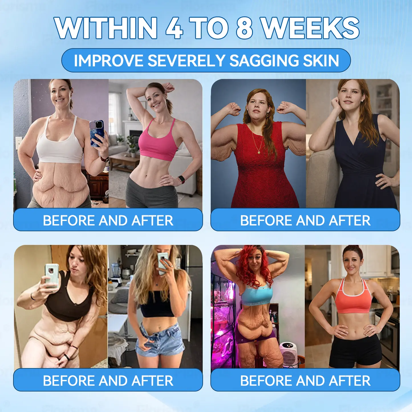 ๐ญ๐๐๐๐๐๐๐ยฎ ๐ท๐ณ๐จ๐ต๐ป-๐ซ๐ฌ๐น๐ฐ๐ฝ๐ฌ๐ซ ๐ช๐๐๐๐๐๐๐ ๐บ๐๐๐๐๐๐ ๐ช๐๐๐๐๐๐ ๐ท๐๐๐๐(Plant energy helps reduce weight by improving the body's lymphatic system)๐ฉน