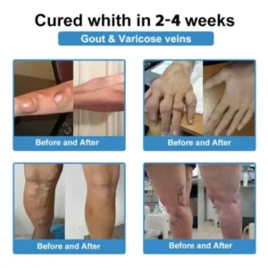 ✅ Official Store: Skavix® Nano-Microneedle Joint Patch