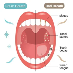Qooes™ Niacinamide Whitening Toothpaste