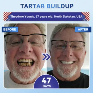 Alisanda® 🦷 Tideglusib Fast‑Dissolving Tooth & Gum Repair Oral Strips ✨