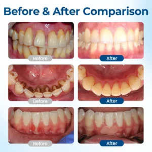 Biancat® GumHoney Oral Repair Drops