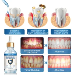 Biancat® GumHoney Oral Repair Drops