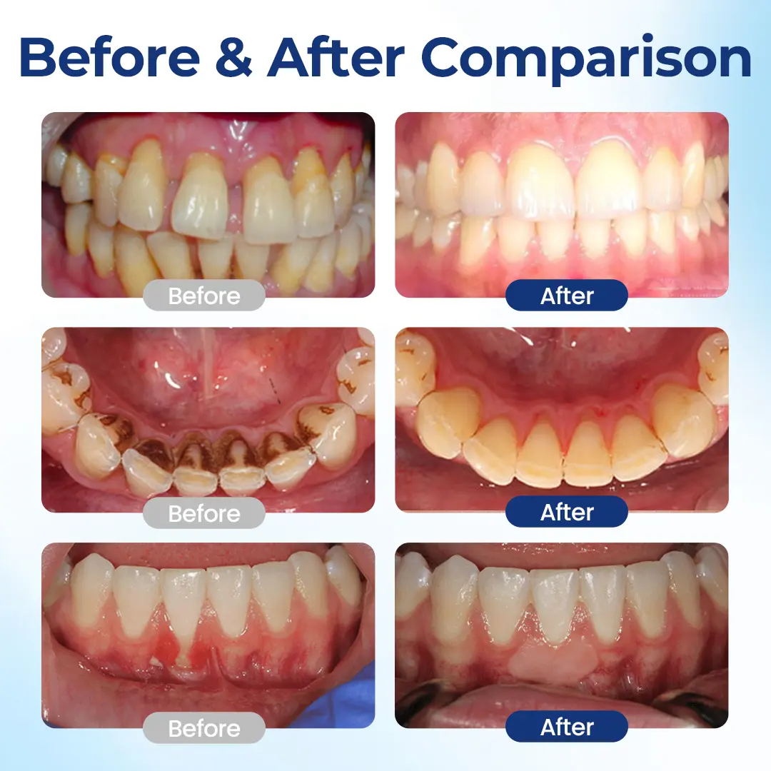 Biancat® GumViva Oral Repair Solution