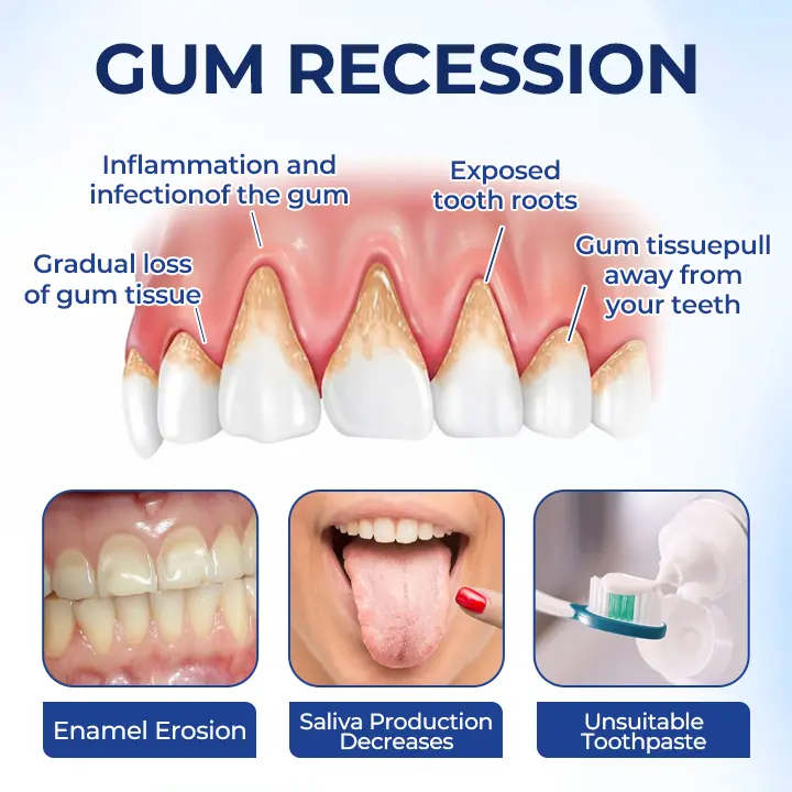 Biancat® GumViva Oral Repair Solution