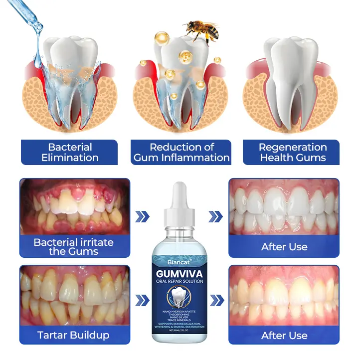 Biancat® GumViva Oral Repair Solution