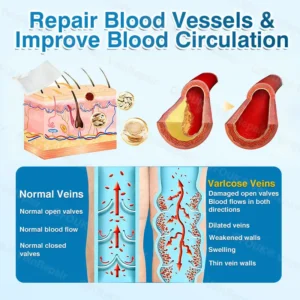 🇬🇧👨‍⚕️✅👍GFOUK® VeinRepair Microneedle Patch Roll⚡Instant Relief, Long-Term Results