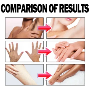 ODALIT™ Hair Removal Mousse for Mrs