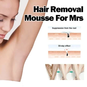 ODALIT™ Hair Removal Mousse for Mrs
