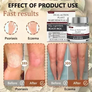 SEAGRIL™ 𝐁𝐥𝗮𝐜𝐤 𝐑𝐢𝐜𝗲 𝐒𝐤𝗶𝐧 𝐑𝗲𝐩𝐚𝗶𝐫 𝐄𝐬𝐬𝗲𝐧𝐜𝐞 𝐂𝐫𝗲𝗮𝐦