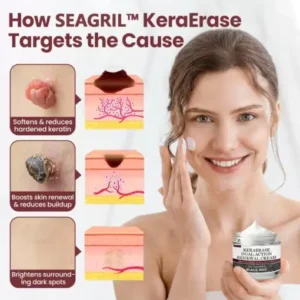 SEAGRIL™ 𝐁𝐥𝗮𝐜𝐤 𝐑𝐢𝐜𝗲 𝐒𝐤𝗶𝐧 𝐑𝗲𝐩𝐚𝗶𝐫 𝐄𝐬𝐬𝗲𝐧𝐜𝐞 𝐂𝐫𝗲𝗮𝐦