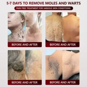 SEAGRIL™ 𝐁𝐥𝗮𝐜𝐤 𝐑𝐢𝐜𝗲 𝐒𝐤𝗶𝐧 𝐑𝗲𝐩𝐚𝗶𝐫 𝐄𝐬𝐬𝗲𝐧𝐜𝐞 𝐂𝐫𝗲𝗮𝐦