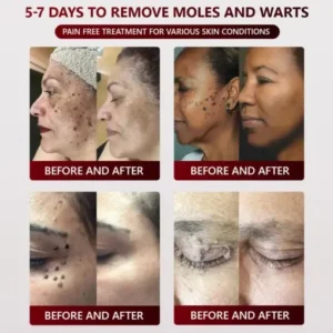 SEAGRIL™ 𝐁𝐥𝗮𝐜𝐤 𝐑𝐢𝐜𝗲 𝐒𝐤𝗶𝐧 𝐑𝗲𝐩𝐚𝗶𝐫 𝐄𝐬𝐬𝗲𝐧𝐜𝐞 𝐂𝐫𝗲𝗮𝐦