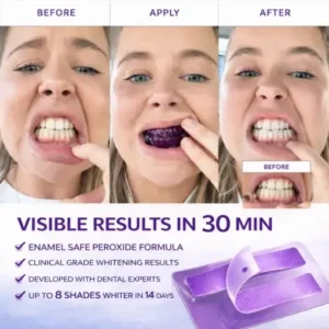 SEAGRIL™ Novora Purple Teeth Whitening Strips