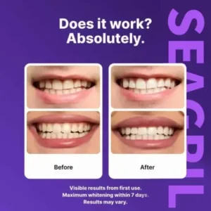 SEAGRIL™ Novora Purple Teeth Whitening Strips