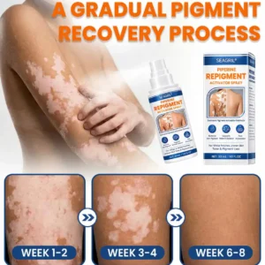 SEAGRIL® Piperine Repigment Activator Spray to Reactivate Dormant Pigment Cells & Restore Natural Skin Color