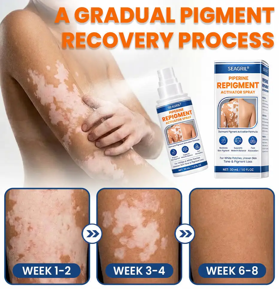 SEAGRIL® Piperine Repigment Activator Spray to Reactivate Dormant Pigment Cells & Restore Natural Skin Color