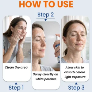 SEAGRIL® Piperine Repigment Activator Spray to Reactivate Dormant Pigment Cells & Restore Natural Skin Color