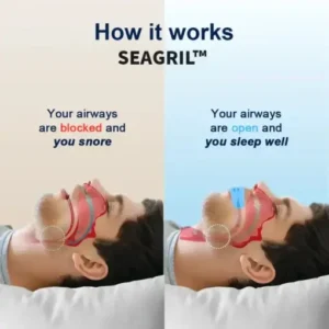 SEAGRIL™ Professional intelligent anti-snoring device