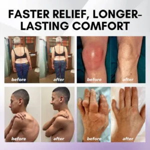 SEAGRIL™ Turmeric & Emu Oil Arthritis Soothing Pain Relief Massage Gel