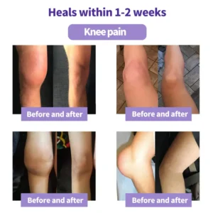 SEAGRIL™ Turmeric & Emu Oil Arthritis Soothing Pain Relief Massage Gel