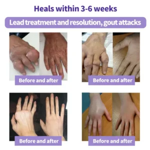 SEAGRIL™ Turmeric & Emu Oil Arthritis Soothing Pain Relief Massage Gel