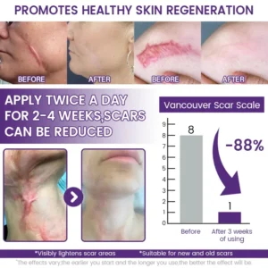 Seagril® ReGenScar Stem Cell Scar Gel