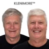 ⏰ KLENIMORE™ Custom-Fit Dentures ENDS TODAY 70% OFF | Smile with Confidence