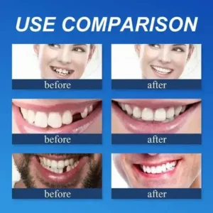 ⏰Ends Today: 70% OFF! 🌎KLENIMORE™ Custom-Fit Dentures— Designed for Comfort and a Natural-Looking Smile