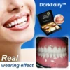 -Ends Today: 70% OFF!🦷DarkFairy™ Custom-Fit Full Functional Dentures Make you more confident