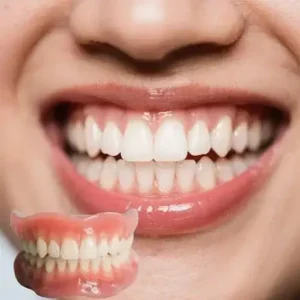 -Ends Today: 70% OFF!🦷DarkFairy™ Custom-Fit Full Functional Dentures Make you more confident