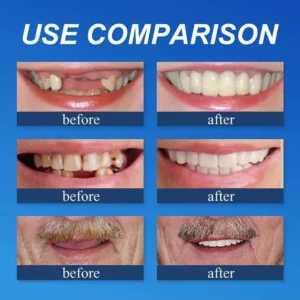 --Ends Today: 75% OFF! ⏰DarkFairy™ Medical Full Denture with Strong Suctiond Custom-Fit Full Functional Dentures🦷