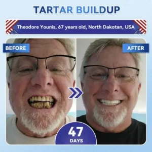 Glimmerly® Tooth & Gum Repair