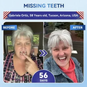 Glimmerly® Tooth & Gum Repair