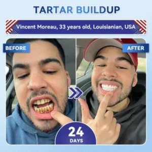 Glimmerly® Tooth & Gum Repair