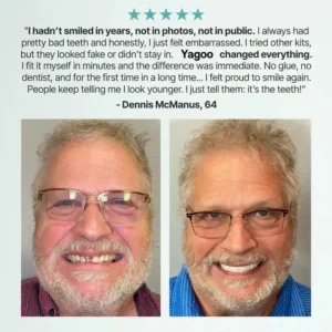 KLENIMORE™ Custom Dentures 2026 | Secure Natural Fit