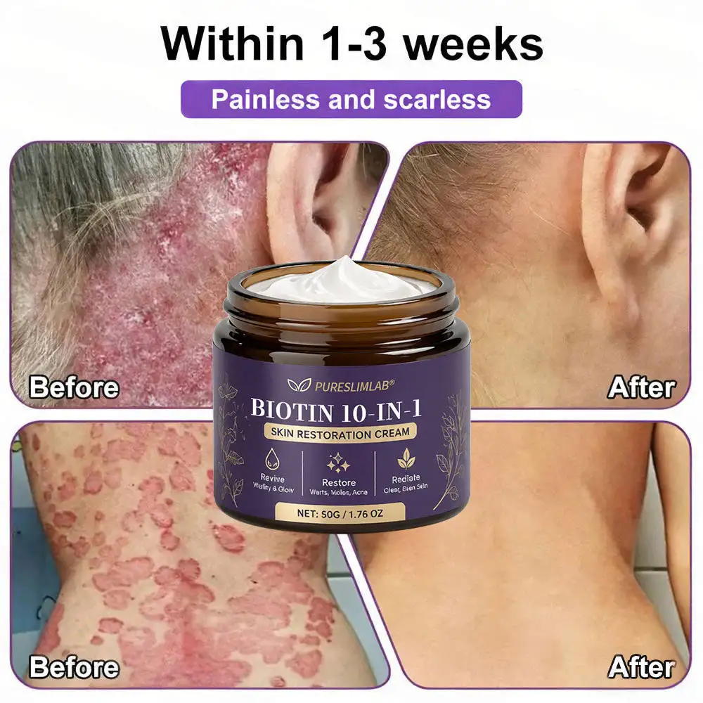 PURESLIMLAB® Biotin Cream 2026 | Skin Repair Formula