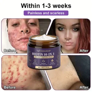 PURESLIMLAB® Biotin Cream 2026 | Skin Repair Formula