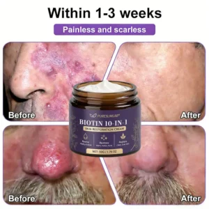 PURESLIMLAB® Biotin Cream 2026 | Skin Repair Formula