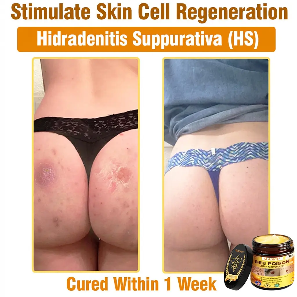 SEAGRIL® 𝐁𝐞𝐞 𝐏𝐨𝐢𝐬𝐨𝐧 𝐀𝐥𝐥-𝐢𝐧-𝐎𝐧𝐞 𝐂𝐫𝐞𝐚𝐦