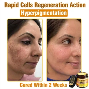 SEAGRIL® 𝐁𝐞𝐞 𝐏𝐨𝐢𝐬𝐨𝐧 𝐀𝐥𝐥-𝐢𝐧-𝐎𝐧𝐞 𝐂𝐫𝐞𝐚𝐦