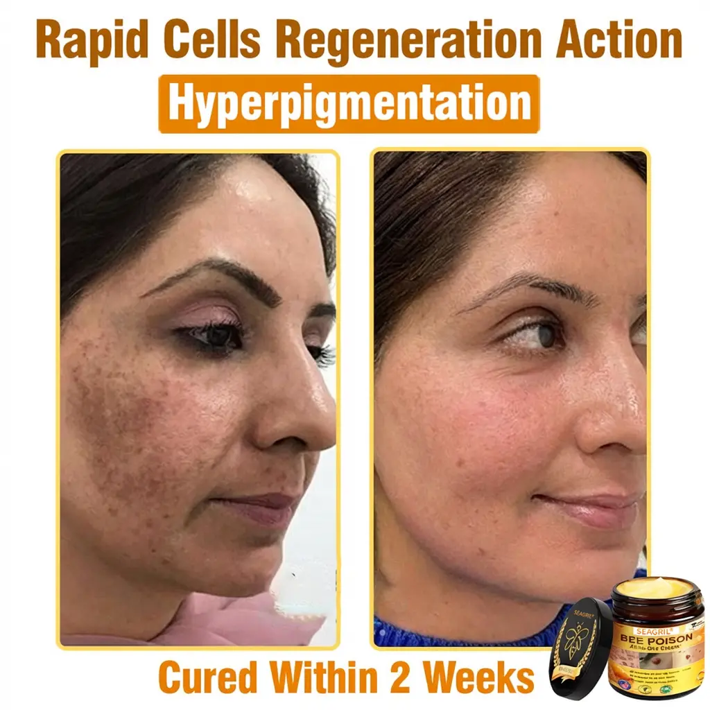 SEAGRIL® 𝐁𝐞𝐞 𝐏𝐨𝐢𝐬𝐨𝐧 𝐀𝐥𝐥-𝐢𝐧-𝐎𝐧𝐞 𝐂𝐫𝐞𝐚𝐦