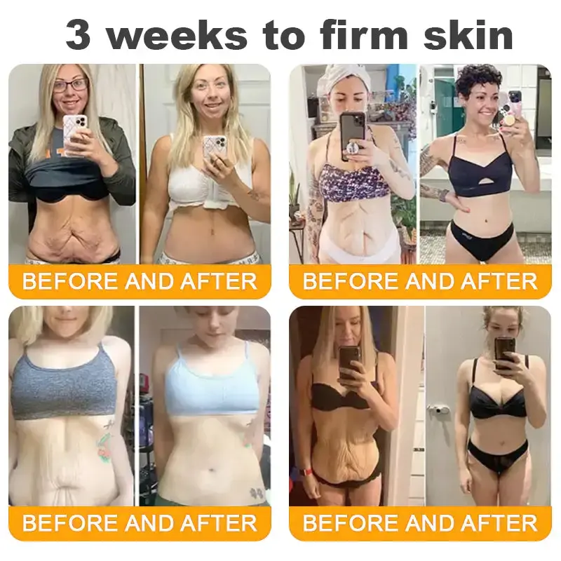 SEAGRIL® 𝐁𝐞𝐞 𝐏𝐨𝐢𝐬𝐨𝐧 𝐀𝐥𝐥-𝐢𝐧-𝐎𝐧𝐞 𝐂𝐫𝐞𝐚𝐦